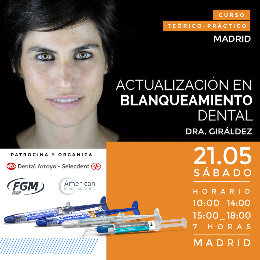 Curso Blanqueamiento Madrid