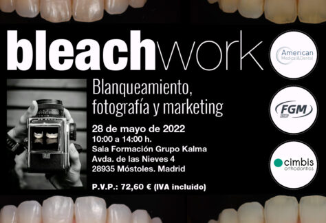 Blanqueamiento fotografía y marketing Madrid