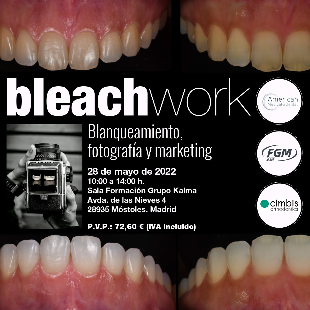Blanqueamiento fotografía y marketing Madrid