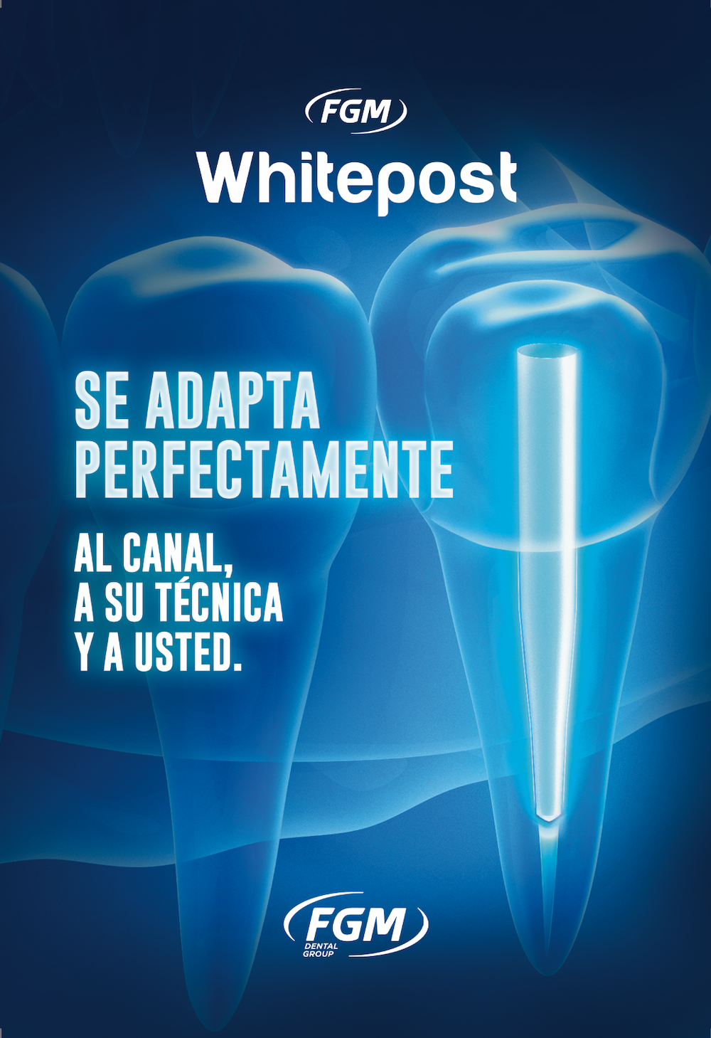 Whitepost, los pernos que se adaptan perfectamente